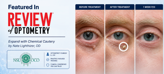 Featured in Review of Optometry: Our Take on "Expand with Chemical Cautery"