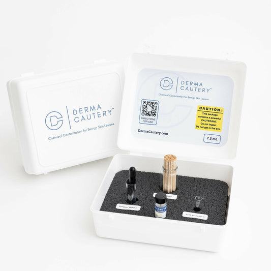 The Derma Cautery™ Kit includes all necessary tools for over 200 treatments, providing an alternative to electro or cryosurgery. Suitable for medical professionals aiming to expand their service offerings.